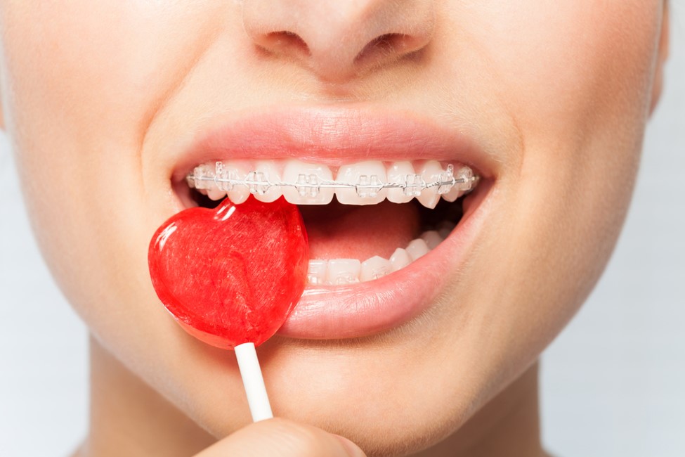 Halloween Candy To Avoid If You Have Braces Pearly Whites Dental